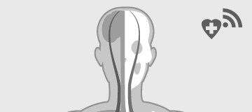 HealthOn DiGA-Radar: Gehirn/Nerven